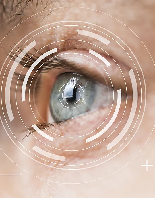 Close-up of an eye with a diagnostic scan overlay — a cataract forms on the lens behind the pupil