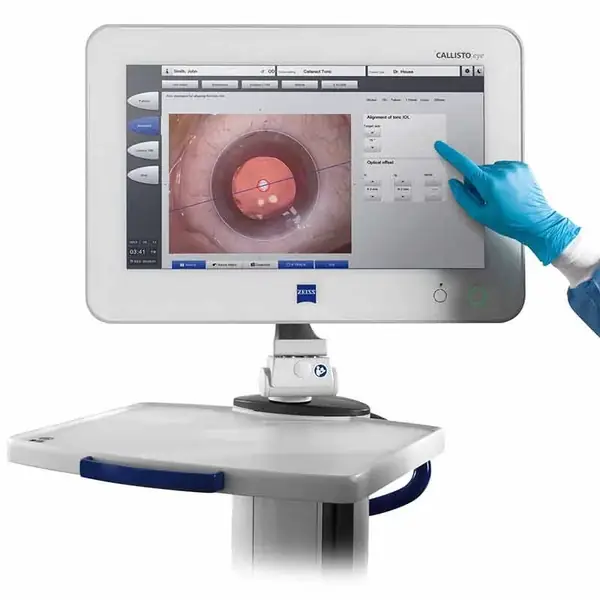 The ZEISS CALLISTO eye system, which projects lens-alignment guidance into the surgeon's microscope during cataract surgery